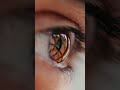 What Is Low Vision? Chris in Denver’s Guess