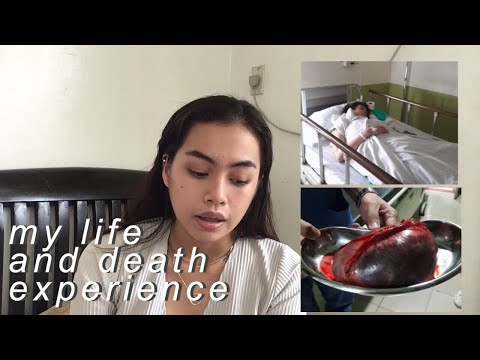 I only have one ovary and fallopian tube left | Philippines