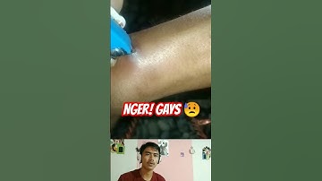 CABUT DURI DI DALAM DAGING #viral #shorts #reels #fyp