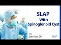 SLAP with Spinoglenoid Cyst