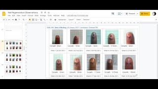 Adding Nail Pictures on Google Slides | Tracking Nail Growth: A Citizen Science Project screenshot 5