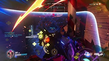 Can d.va block zarya