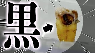 何事も立体的、多角的に見ることが大切です　上から見たらただの歯でも横から見たら虫歯やねん　　歯医者かおりです