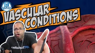 NPTE Practice Questions: Vascular Conditions