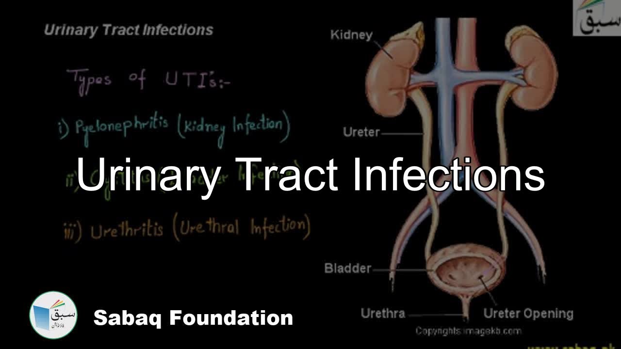 Urinary tract infection after sex — 3