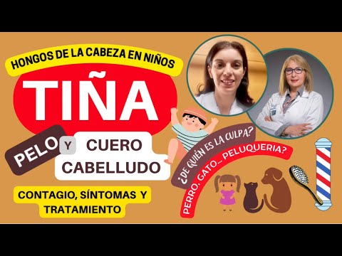 TIÑA del CUERO CABELLUDO. ¿HONGOS en la CABEZA? CONTAGIO, SÍNTOMAS  y TRATAMIENTO @depielapiel