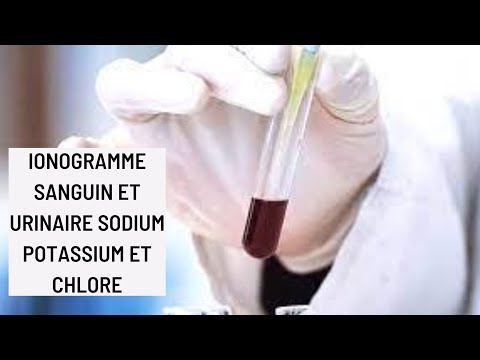 Vidéo: Hyperchlorémie (taux De Chlorure élevés): Traitement Et Causes
