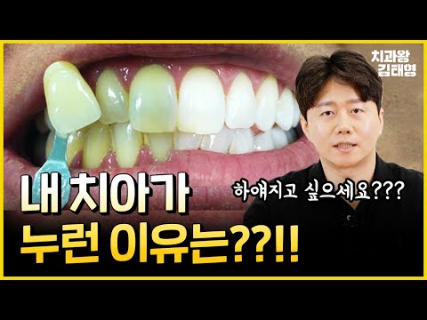 누렇게 된 치아 ! 새하얗게 하는 방법 | 원인과 예방법은? 치아미백의 모든 것