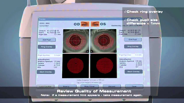 iProfiler Tutorial