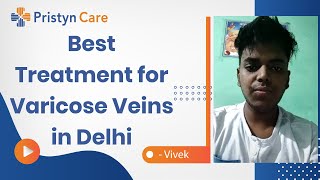 Treatment for Varicose Veins in Delhi | Laser Surgery | वैरिकोज वेन्स | Patient Reviews |