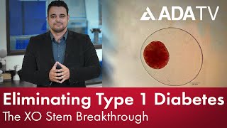 Eliminating Type 1 Diabetes The Xostem Breakthrough