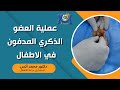 عملية العضو الذكري المدفون في الاطفال دكتور محمد أنس