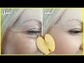 How to Remove Under Eye WRINKLES & Fine Lines in 1 Week, With Apple Mask at Home 🍏
