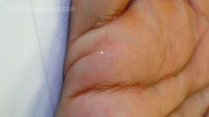 MARRIAGE & CHILDREN lines really don't LIE | Palm Reading