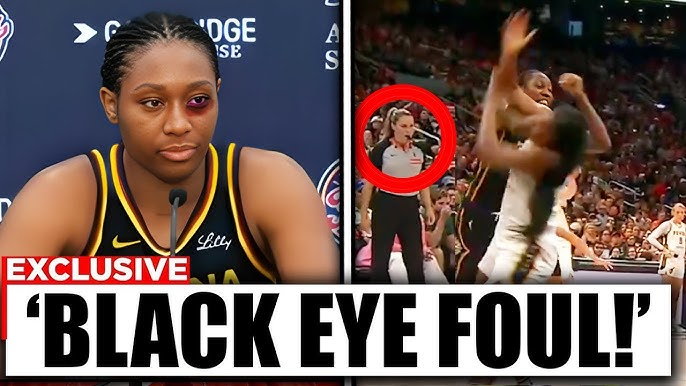 Aliyah Boston BLACK EYE Lỗi không được chú ý khi trọng tài đứng cách đó 5 feet! ĐIỀU NÀY THẬT KHỦNG KHIẾP!