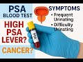PSA Blood Test Explained | High PSA Levels? | Prostate Health Warning Signs! #prostatecancer