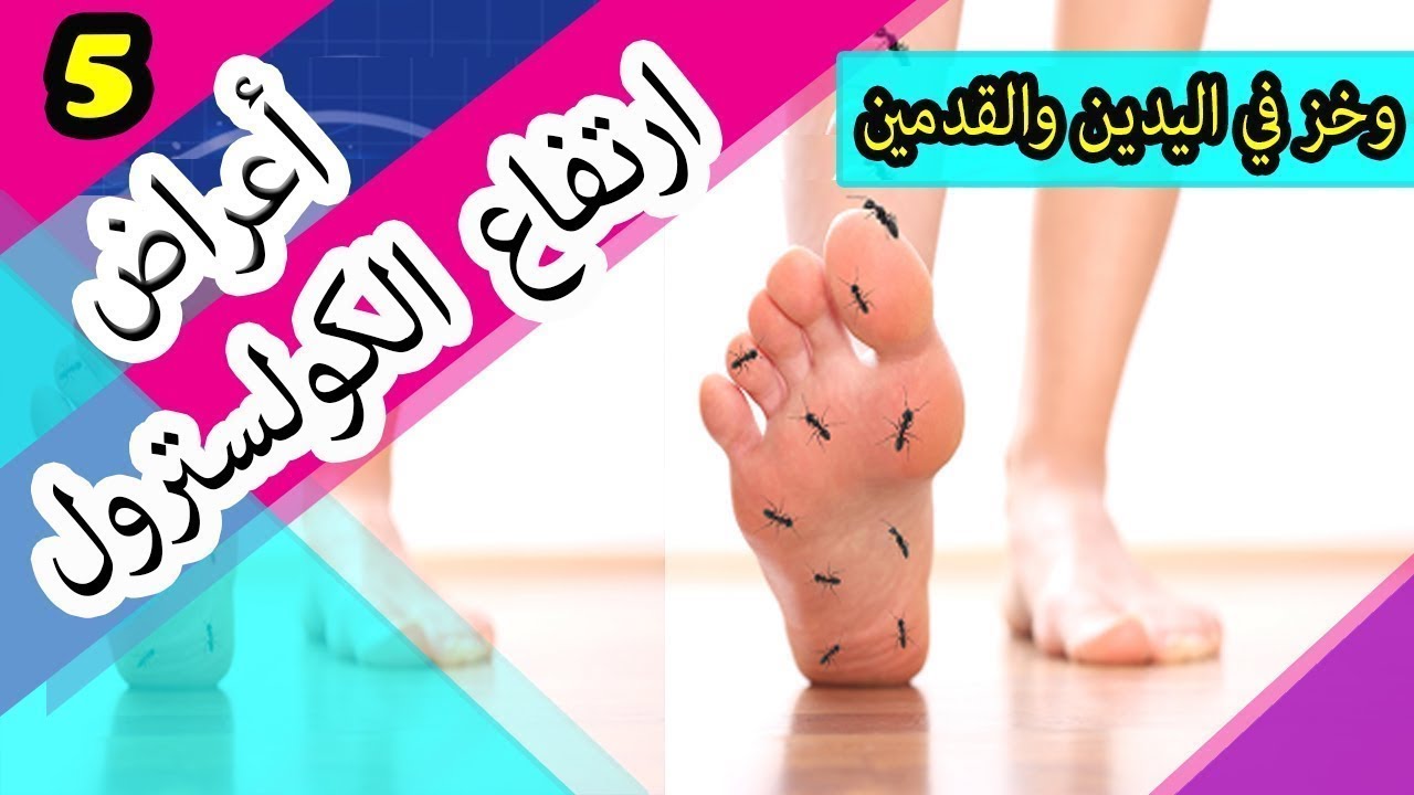 الكولسترول المرتفع اعراض الكوليسترول: أفضل