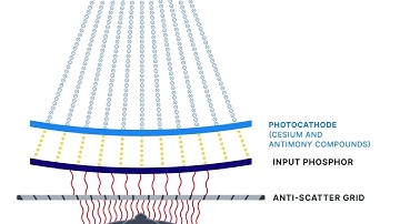 What is an image intensifier, and why is it important?: Fluoroscopy systems and components