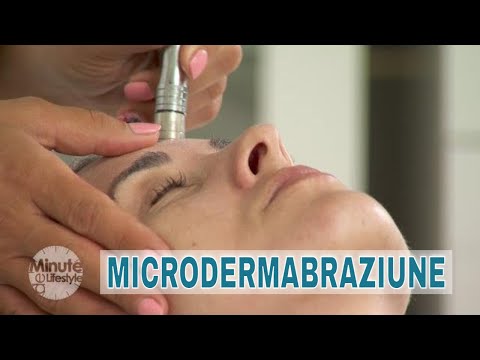 Video: ❶ Microdermabraziune - Tratament De înfrumusețare Instantanee
