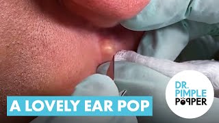 A Lovely Ear Pop