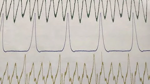 Intake and Exhaust Pressure Waveform Testing for Misfire