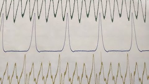 Intake and Exhaust Pressure Waveform Testing for Misfire