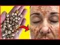WIPE OFF FACIAL BLEMISHES WITH 1 HANDFUL OF CHICKPEAS ! THE MIRACLE MASK WIPING AGE SPOTS, WRINKLES