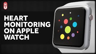 Is the Apple Watch a Health Device or What