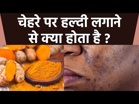 वीडियो: हल्दी कैसे त्वचा को हल्का करती है?