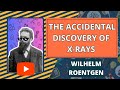 Wilhelm Roentgen. The Accidental Discovery of X-rays. #wilhelmroentgen