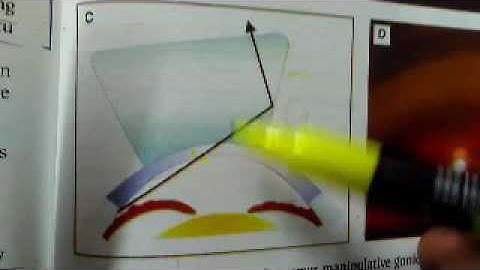 OME gonioscopy principle