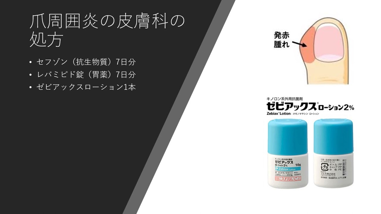 爪周囲炎の皮膚科の処方