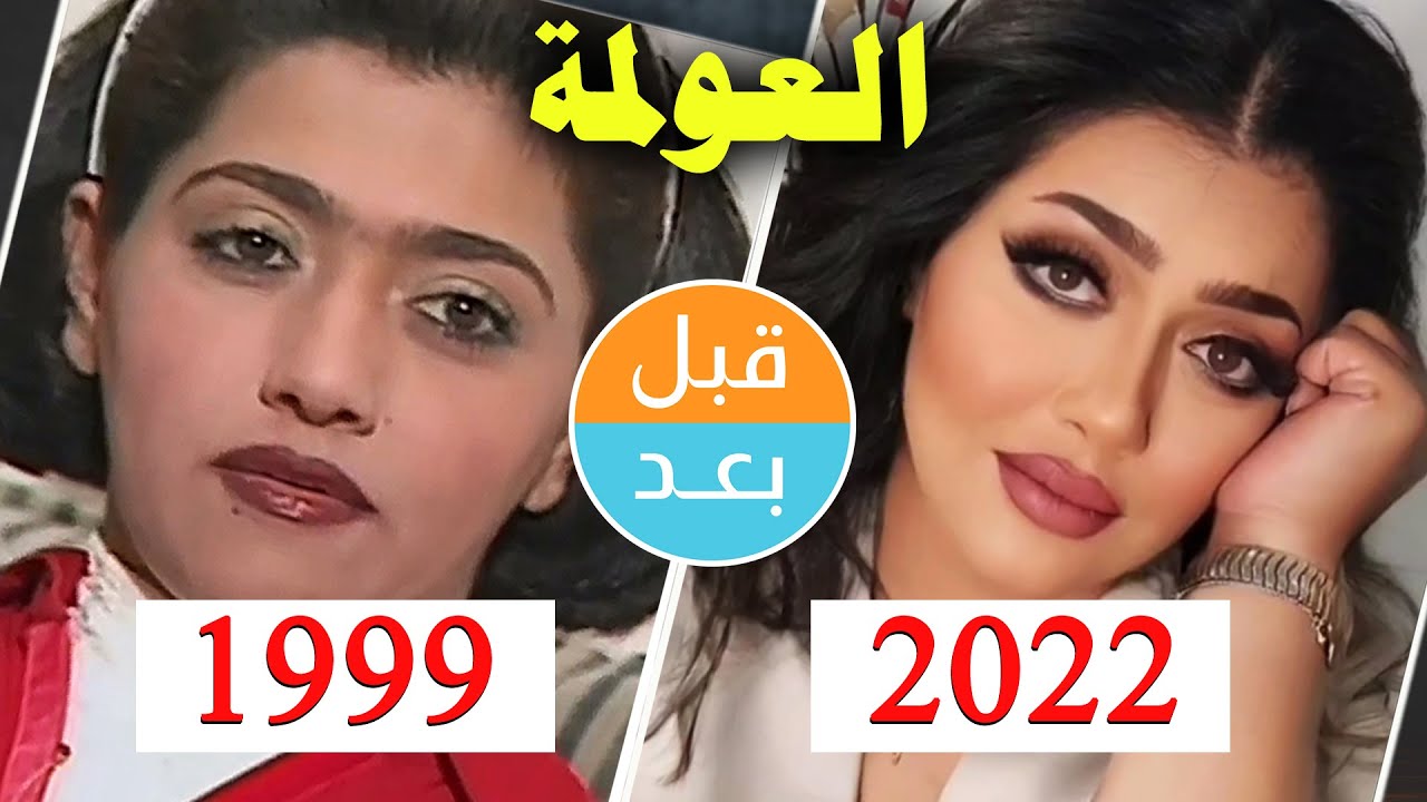 أبطال مسلسل العولمة (1999) بعد 23 سنة .. قبل و بعد 2022 .. before and after