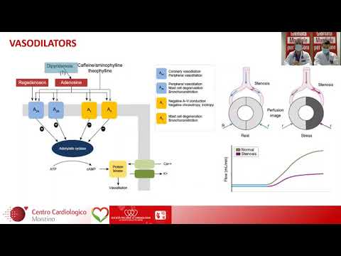 Video: Trattamento Della Cardiopatia Ischemica Con Rimedi E Metodi Popolari