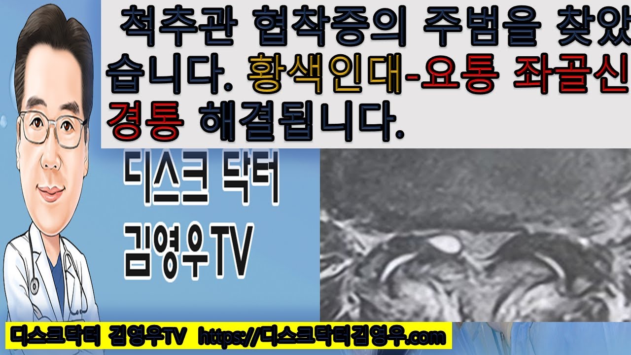 척추관협착증의 주범-두꺼워진 황색인대 요통 좌골신경통 해결됩니다. 디스크탈출증 비수술적추치료 양방향척추내시경김영우 척추신경외과 ...