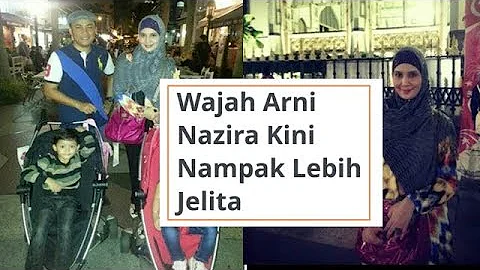 Ini Wajah Terkini Arni Nazira