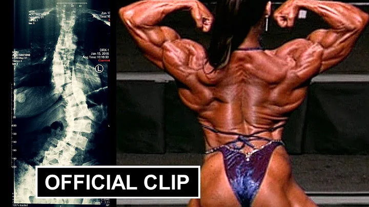 The Truth About My Back!  Pro female bodybuilder Denise Masino tells how she deals (with Scoliosis)