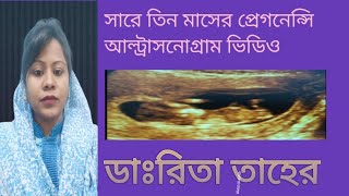 সারে তিন মাসের একটি প্রেগনেন্সি আল্ট্রাসনোগ্রাম ভিডিও pregnancy pregnancy ultrasound usg ultra