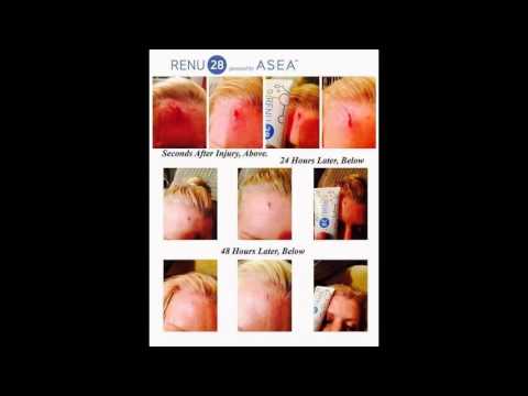 ASEA Renu 28