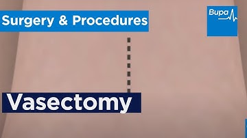 How a vasectomy is carried out | Bupa Health