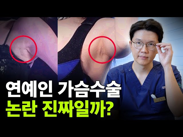 성형외과 전문의가 알려주는 연예인 가슴성형의 특징