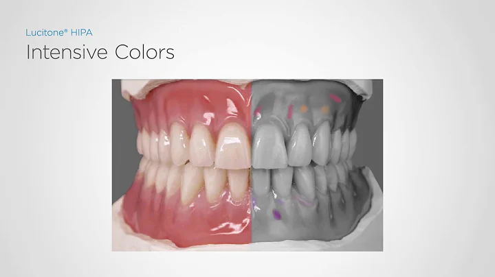 Lucitone HIPA - pourable acrylic denture base for improved durability | Dentsply Sirona