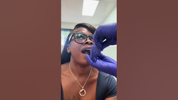 I finally opened that email😅 the results are up now📸 ‼️