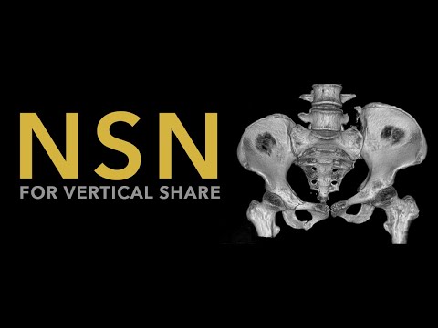 NsN for Vertical share