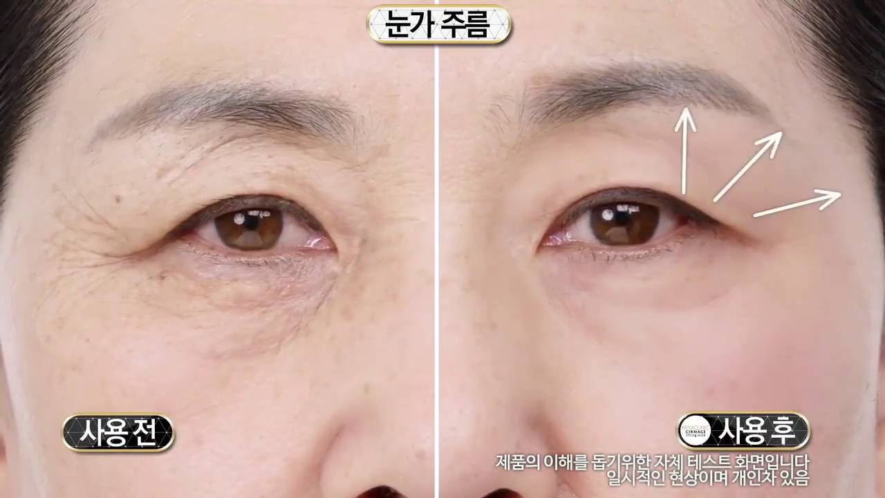 anti aging lifting csíkok)