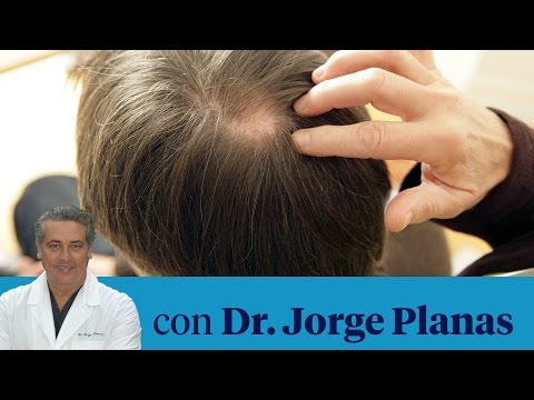 Vídeo: Acupuntura Para La Pérdida De Cabello: ¿es Efectiva?