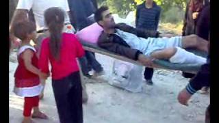 أحد الجرحة اللاجئن إلى تركية 8/6/2011