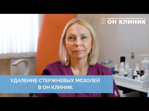 Лечение (удаление) стержневых мозолей в ОН КЛИНИК.