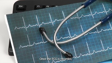 How AI Powers ECG Analysis: Inside the Working of HFP (Heart Failure Predictor) Tool | HAIF