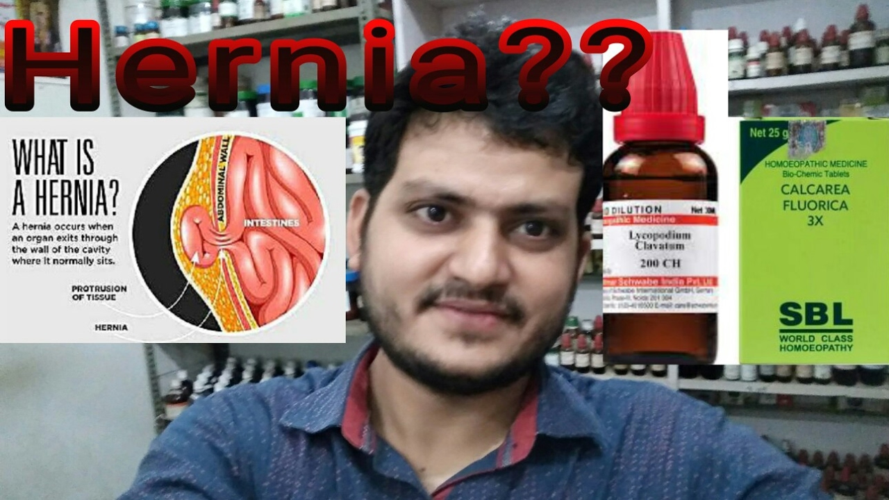 Hernia! Homeopathic medicine for hernia?? explian! YouTube Hernia! Homeopathic medicine for hernia?? explian! YouTube